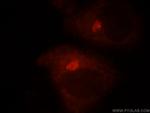 GOLGA3 Antibody in Immunocytochemistry (ICC/IF)