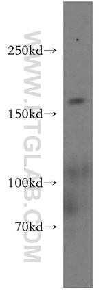 GOLGA3 Antibody in Western Blot (WB)