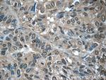 EYA3 Antibody in Immunohistochemistry (Paraffin) (IHC (P))