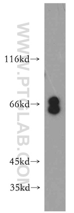 EYA3 Antibody in Western Blot (WB)