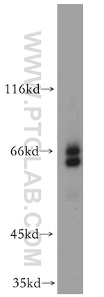 EYA3 Antibody in Western Blot (WB)