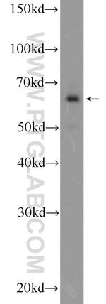 EYA3 Antibody in Western Blot (WB)