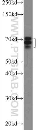 EYA3 Antibody in Western Blot (WB)