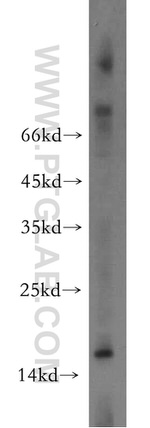 FAM72 Antibody in Western Blot (WB)