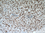 NUDCD2 Antibody in Immunohistochemistry (Paraffin) (IHC (P))