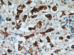 NUDCD2 Antibody in Immunohistochemistry (Paraffin) (IHC (P))