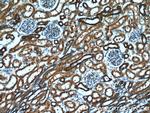 NUDCD2 Antibody in Immunohistochemistry (Paraffin) (IHC (P))