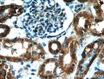 NUDCD2 Antibody in Immunohistochemistry (Paraffin) (IHC (P))