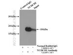 NUDCD2 Antibody in Immunoprecipitation (IP)
