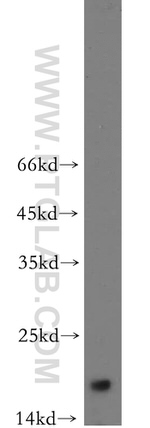 NUDCD2 Antibody in Western Blot (WB)