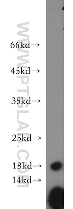 NUDCD2 Antibody in Western Blot (WB)