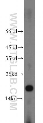 NUDCD2 Antibody in Western Blot (WB)