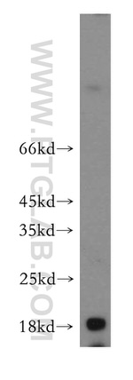 NUDCD2 Antibody in Western Blot (WB)