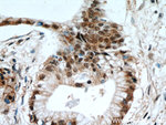 HSPA4 Antibody in Immunohistochemistry (Paraffin) (IHC (P))