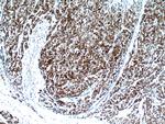 HSPA4 Antibody in Immunohistochemistry (Paraffin) (IHC (P))