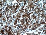 HSPA4 Antibody in Immunohistochemistry (Paraffin) (IHC (P))