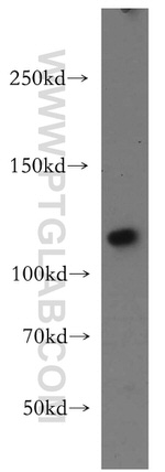 HSPA4 Antibody in Western Blot (WB)