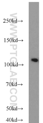 HSPA4 Antibody in Western Blot (WB)