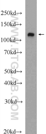 HSPA4 Antibody in Western Blot (WB)