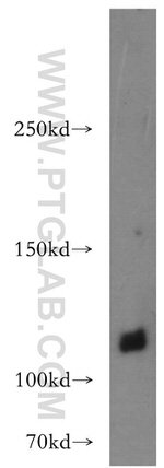 HSPA4 Antibody in Western Blot (WB)