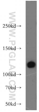 HSPA4 Antibody in Western Blot (WB)