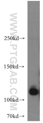 HSPA4 Antibody in Western Blot (WB)