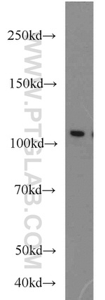 HSPA4 Antibody in Western Blot (WB)