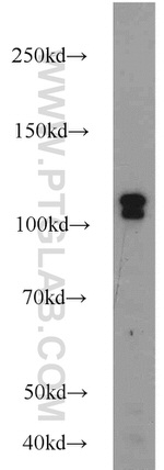 HSPA4 Antibody in Western Blot (WB)