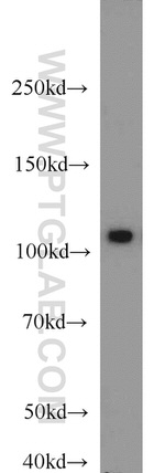 HSPA4 Antibody in Western Blot (WB)