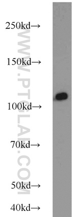 HSPA4 Antibody in Western Blot (WB)