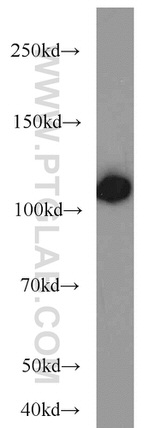 HSPA4 Antibody in Western Blot (WB)