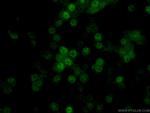 TET2 Antibody in Immunocytochemistry (ICC/IF)