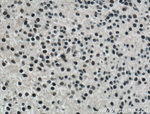 TET2 Antibody in Immunohistochemistry (Paraffin) (IHC (P))