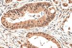 TET2 Antibody in Immunohistochemistry (Paraffin) (IHC (P))