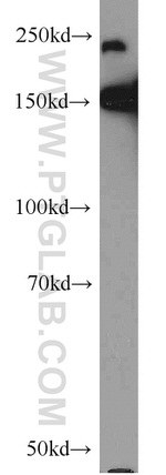 TET2 Antibody in Western Blot (WB)