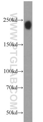 TET2 Antibody in Western Blot (WB)