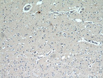 CCDC25 Antibody in Immunohistochemistry (Paraffin) (IHC (P))