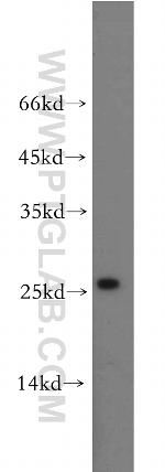 CCDC25 Antibody in Western Blot (WB)
