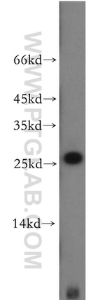 CCDC25 Antibody in Western Blot (WB)