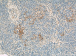 PLOD2 Antibody in Immunohistochemistry (Paraffin) (IHC (P))