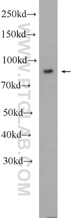 PLOD2 Antibody in Western Blot (WB)