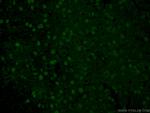 ATOH1 Antibody in Immunohistochemistry (PFA fixed) (IHC (PFA))