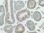 ADAD2 Antibody in Immunohistochemistry (Paraffin) (IHC (P))