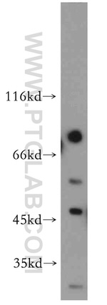 ADAD2 Antibody in Western Blot (WB)