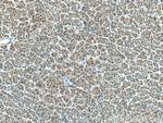 AAMP Antibody in Immunohistochemistry (Paraffin) (IHC (P))