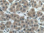 AAMP Antibody in Immunohistochemistry (Paraffin) (IHC (P))