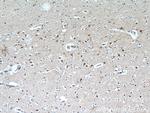 CPLX4 Antibody in Immunohistochemistry (Paraffin) (IHC (P))