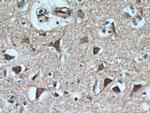 CPLX4 Antibody in Immunohistochemistry (Paraffin) (IHC (P))