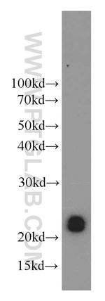 CPLX4 Antibody in Western Blot (WB)