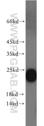 CPLX4 Antibody in Western Blot (WB)